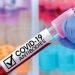 Llegarán anticuerpos contra Covid-19