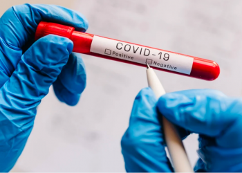 Usan pruebas falsas de Covid-19 para poder viajar a otros países