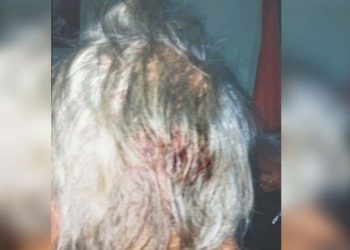 Casi mata a su padre de 88 años a palazos; lo internan en Tampico