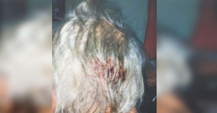 Casi mata a su padre de 88 años a palazos; lo internan en Tampico