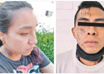 Andrea fue víctima de violencia de pareja y perdió la vista