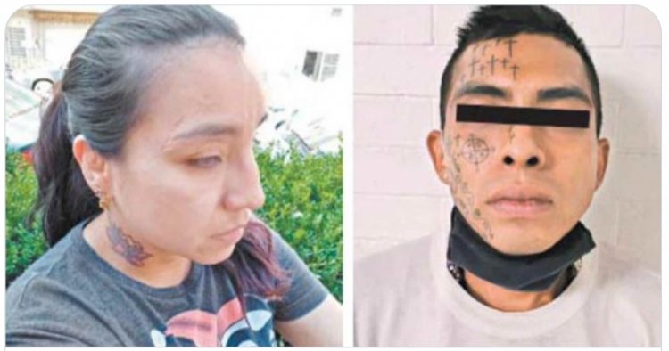 Andrea fue víctima de violencia de pareja y perdió la vista