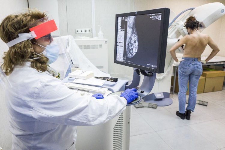 El cáncer de mama supera al de pulmón y se convierte en el más común del mundo