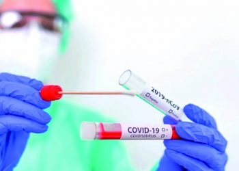 Caen al mínimo casos positivos de coronavirus; hay baja demanda de exámenes