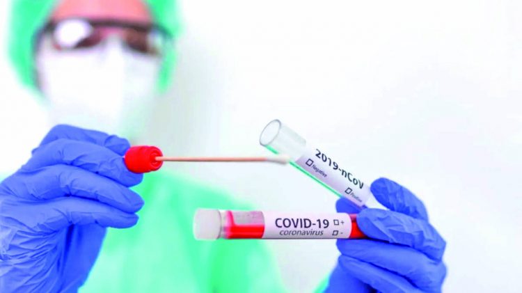 Caen al mínimo casos positivos de coronavirus; hay baja demanda de exámenes