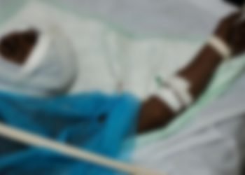 Prende fuego a su esposo porque pensó que había envenenado sus alitas de pollo