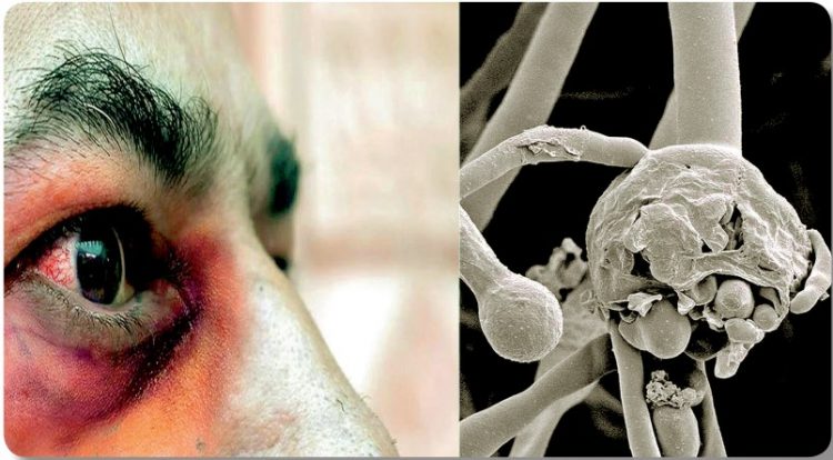 No hay aquí casos de hongo negro