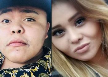 Critican a Gomita por nueva cirugía y la comparan con ‘El Pirata de Culiacán’