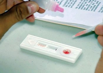 Baja cifra de casos de VIH