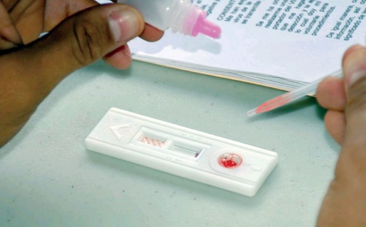 Baja cifra de casos de VIH