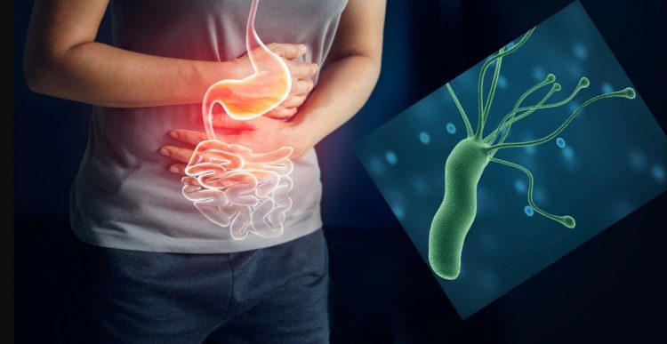 6 de cada 10 mexicanos portan una bacteria que puede producir gastritis y cáncer
