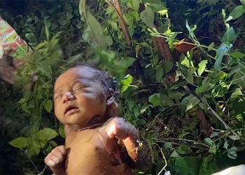 Sobrevive recién nacida abandonada en el bosque cubierto de moretones y picaduras de insectos