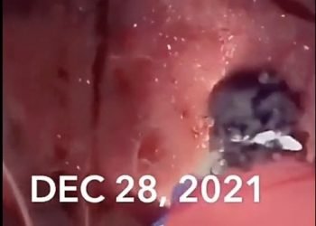 Arrestan a dos jóvenes mujeres incendiarias