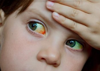 Piden no alarmarse por hepatitis infantil de origen desconocido en México