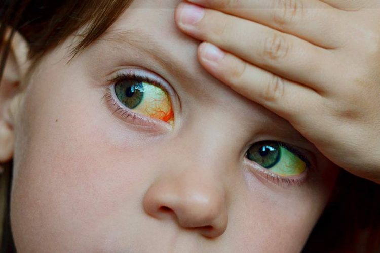 Piden no alarmarse por hepatitis infantil de origen desconocido en México