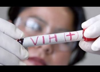 El 25 % de la población podría tener el VIH y desconocerlo