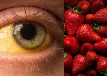 Confirman caso de Hepatitis A en un adulto