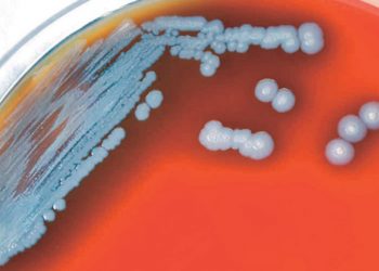 Detectan bacteria mortal en agua y suelo de EU