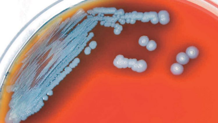 Detectan bacteria mortal en agua y suelo de EU