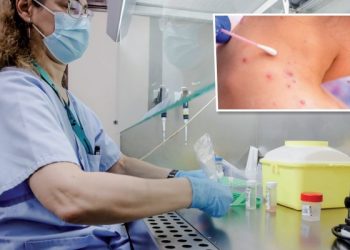 Declara Estados Unidos emergencia por la viruela del mono