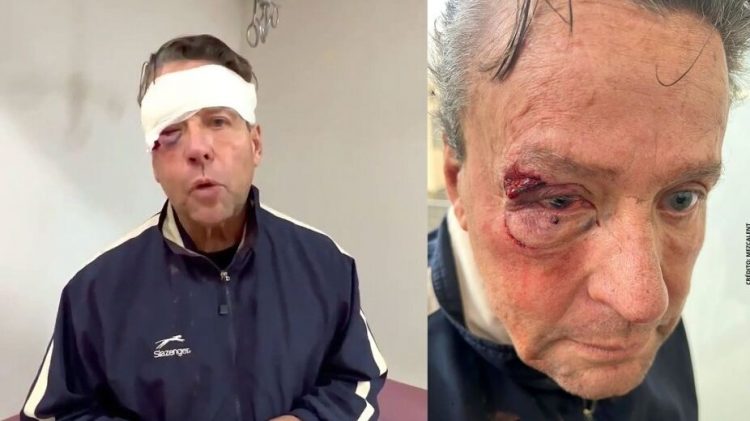 Alfredo Adame sufrió cuatro fracturas tras golpiza | VIDEO