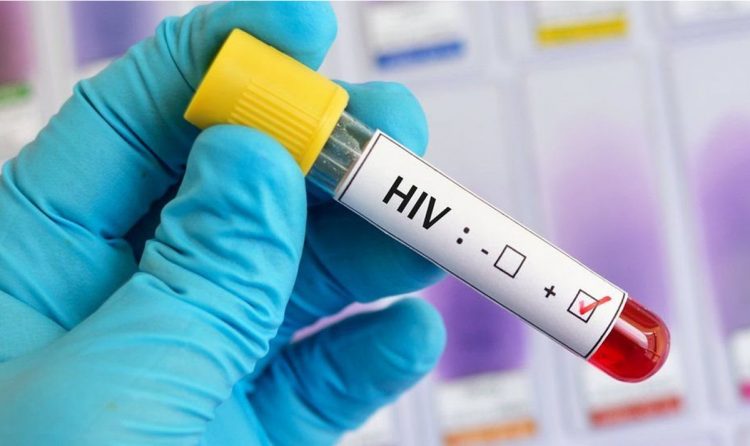 Registra IMSS más de 400 pacientes con VIH