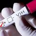 Capasits registró 59 casos de VIH-SIDA en el 2022