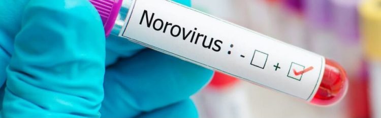Advierten sobre ola de infecciones por norovirus