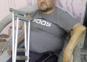 Persona con discapacidad perdió su hogar en incendio, piden ayuda