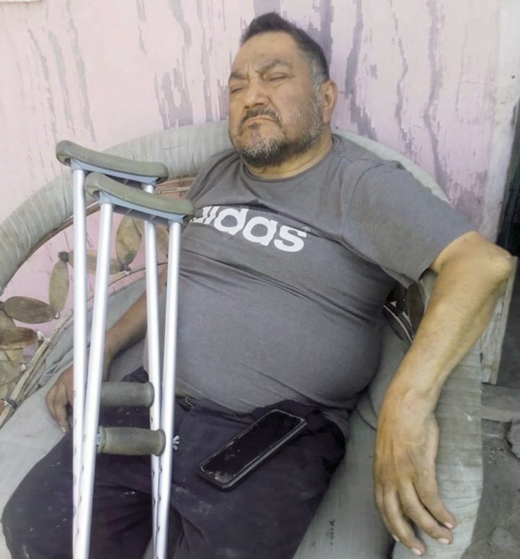 Persona con discapacidad perdió su hogar en incendio, piden ayuda