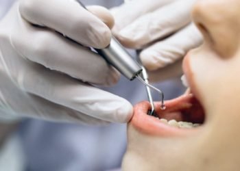 Promueve IMSS salud bucodental