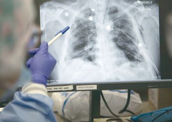 Se mantiene control de tuberculosis y COVID19