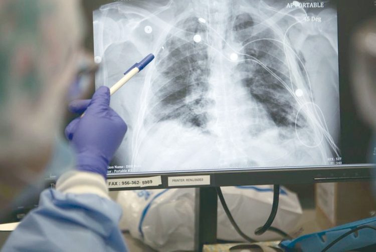 Se mantiene control de tuberculosis y COVID19