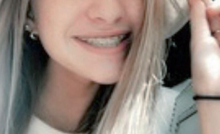 “Reto Benadryl”, otro peligro inminente en las redes sociales