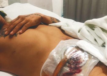 Siguen quejas contra el IMSS por falta de médicos