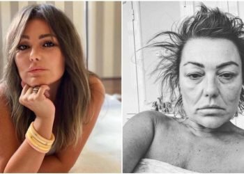 Amaia Montero hospitalizada en la Unidad de Cuidados Intensivos por complicación tras cirugía