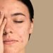 ¡Radiante y libre de acné! Descubre los secretos para prevenir y combatir este molesto problema