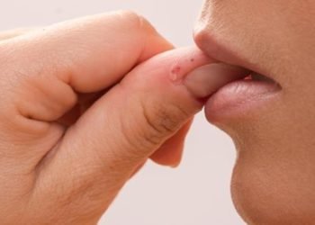 Deja de morderte las uñas: ¡Las claves para lucir unas manos impecables y superar el hábito de por vida!