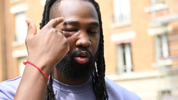 Arresto violento en París del hermano de una víctima de violencia policial desata controversia