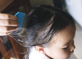 EN CICLO ESCOLAR PASADO Detectan medio salón con piojos