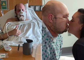 Realizan el Primer Trasplante de Ojo Completo en Estados Unidos