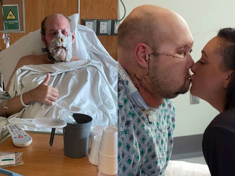 Realizan el Primer Trasplante de Ojo Completo en Estados Unidos