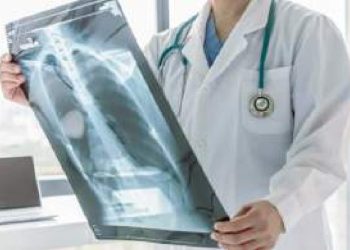 Crece 3% casos de tuberculosis