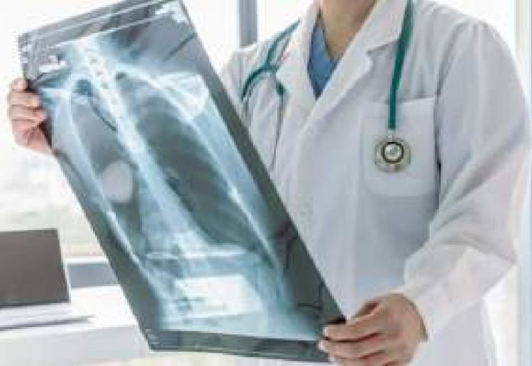 Crece 3% casos de tuberculosis