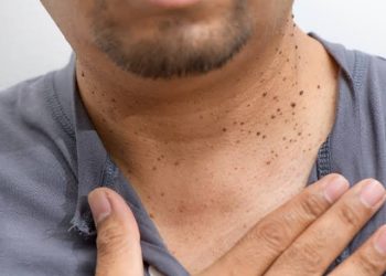 Resistencia a la Insulina: Una Amenaza Silenciosa para la Salud