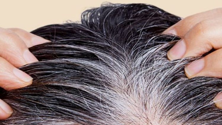 Descubre el Secreto: Cómo Preparar el Shampoo Ideal para Despedirte de las Canas