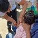 Secretaría de Salud Alerta por Sarampión y Llama a Reforzar la Vigilancia y la Vacunación