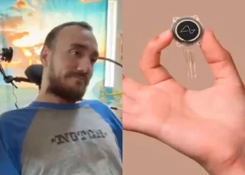 Problemas para Neuralink: Primer Implante de Chip Cerebral en Humano se Desprende