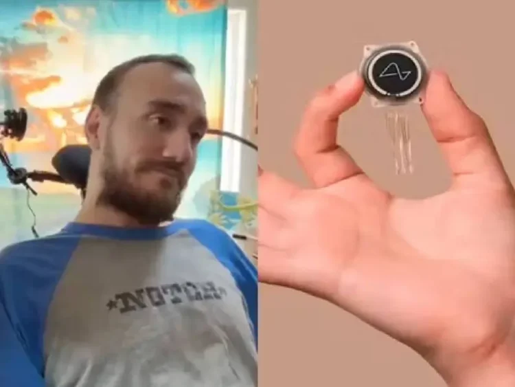 Problemas para Neuralink: Primer Implante de Chip Cerebral en Humano se Desprende