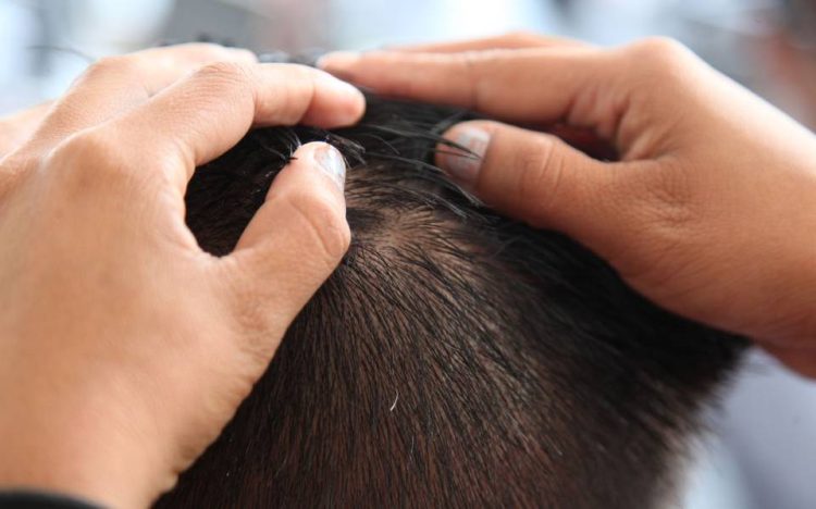 PROLIFERAN CON EL CALOR Detectan piojos en escuelas primarias